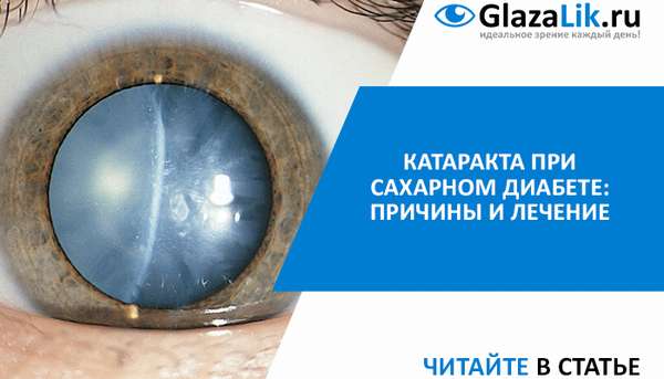 Лечение диабетической катаракты глаз с помощью операции